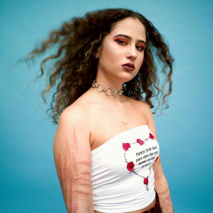 People Shows Their Scars In Powerful Photo Series And Reveals The Story Behind Them