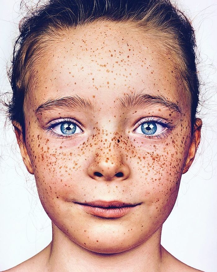 Photographer Captures People With Freckles To Celebrate Their Unique Beauty