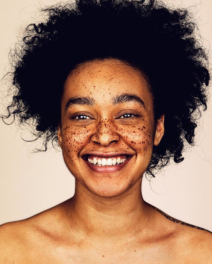 Photographer Captures People With Freckles To Celebrate Their Unique Beauty