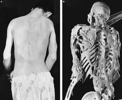 12 Rare Medical Conditions You Never Heard Of