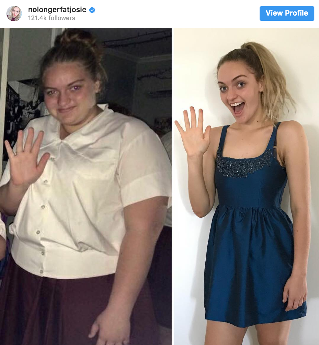Aussie Girl Lost 198 lbs
