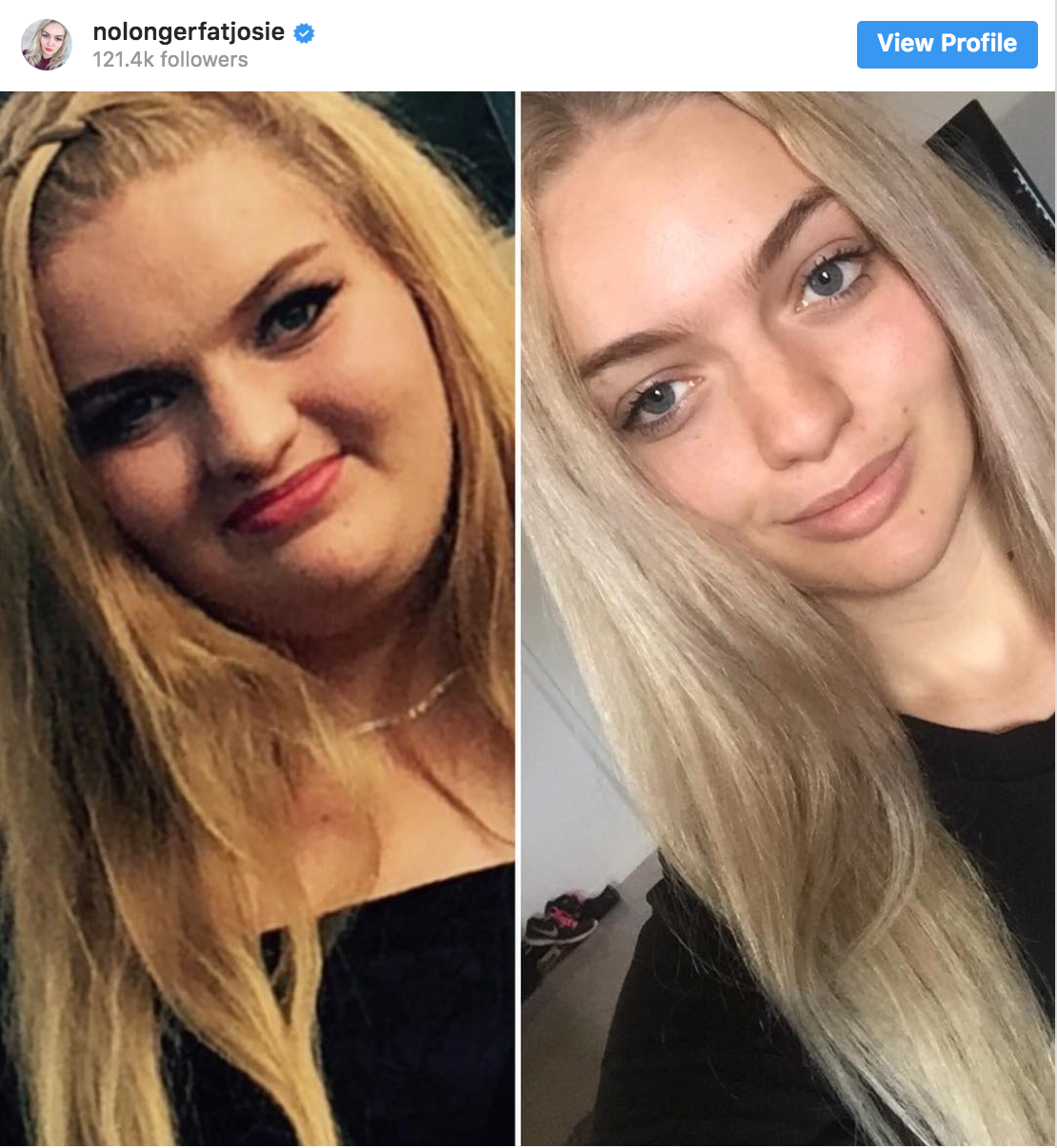 Aussie Girl Lost 198 lbs
